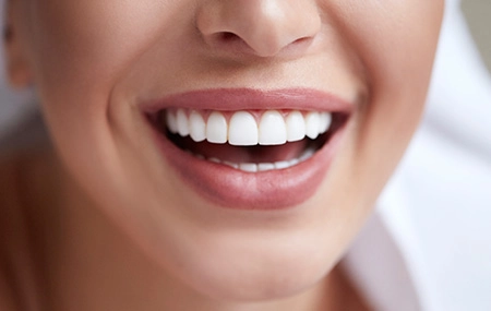 cosmetic treatment for teeth