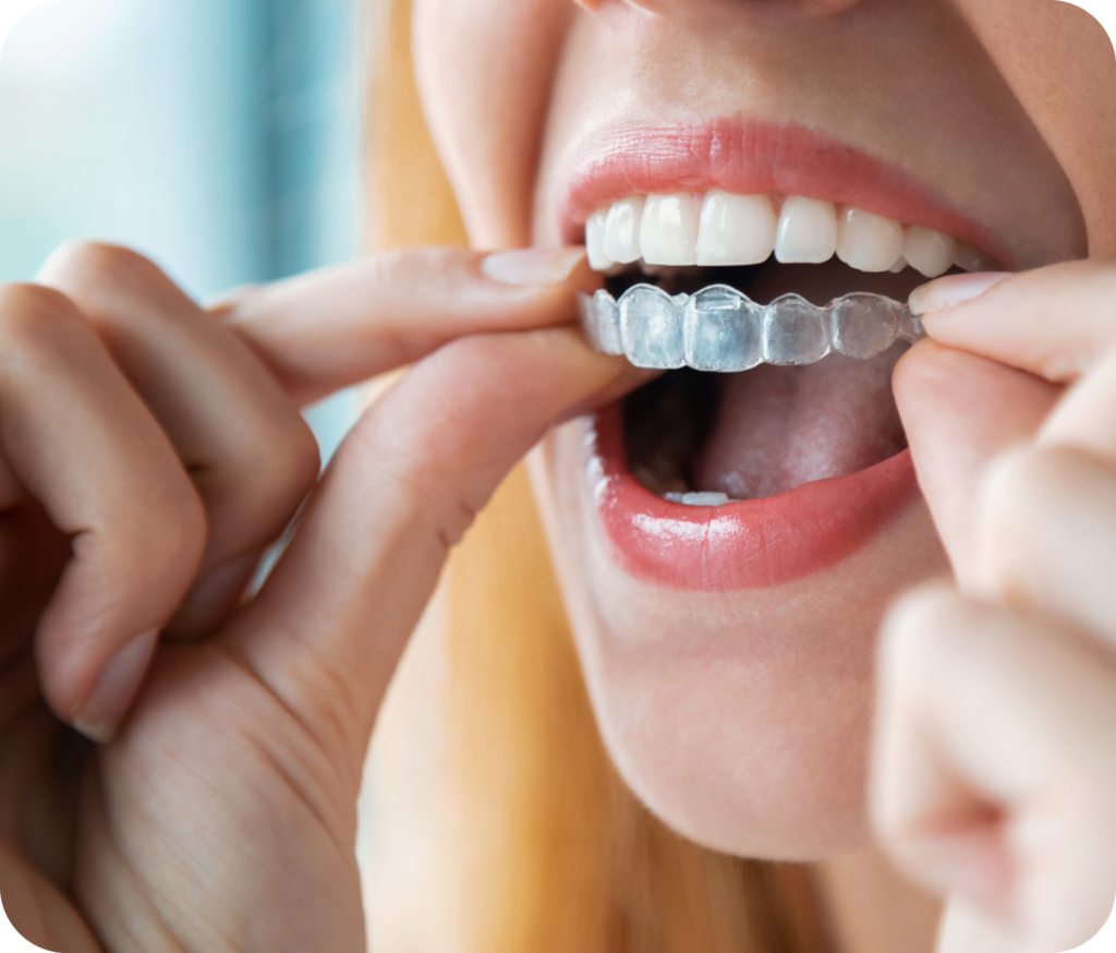 invisalign teen near me