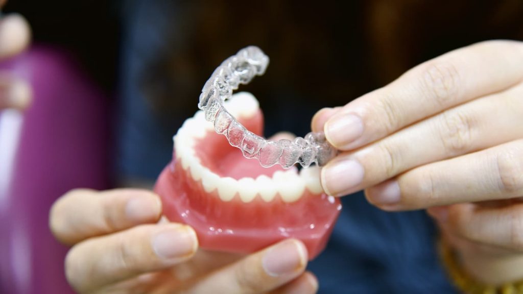 how fast does invisalign work