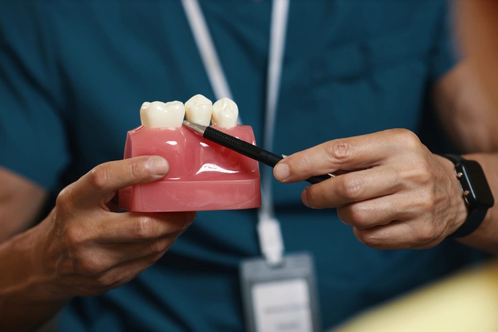 dental bridge infection symptoms