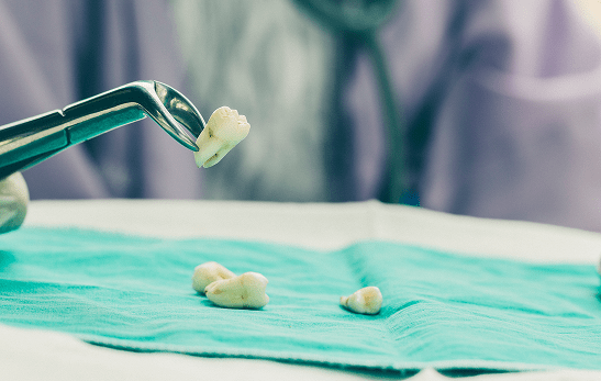 What happens if you have a tooth pulled and don't replace it