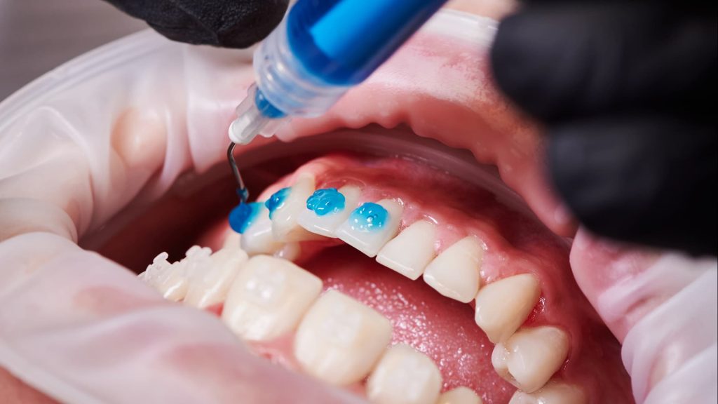 most common dental procedures