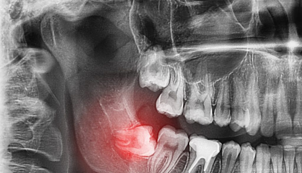 types of dental procedures
