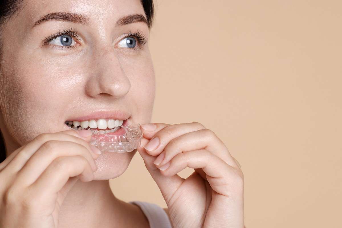How to Straighten Teeth Without Braces: What Actually Works Today