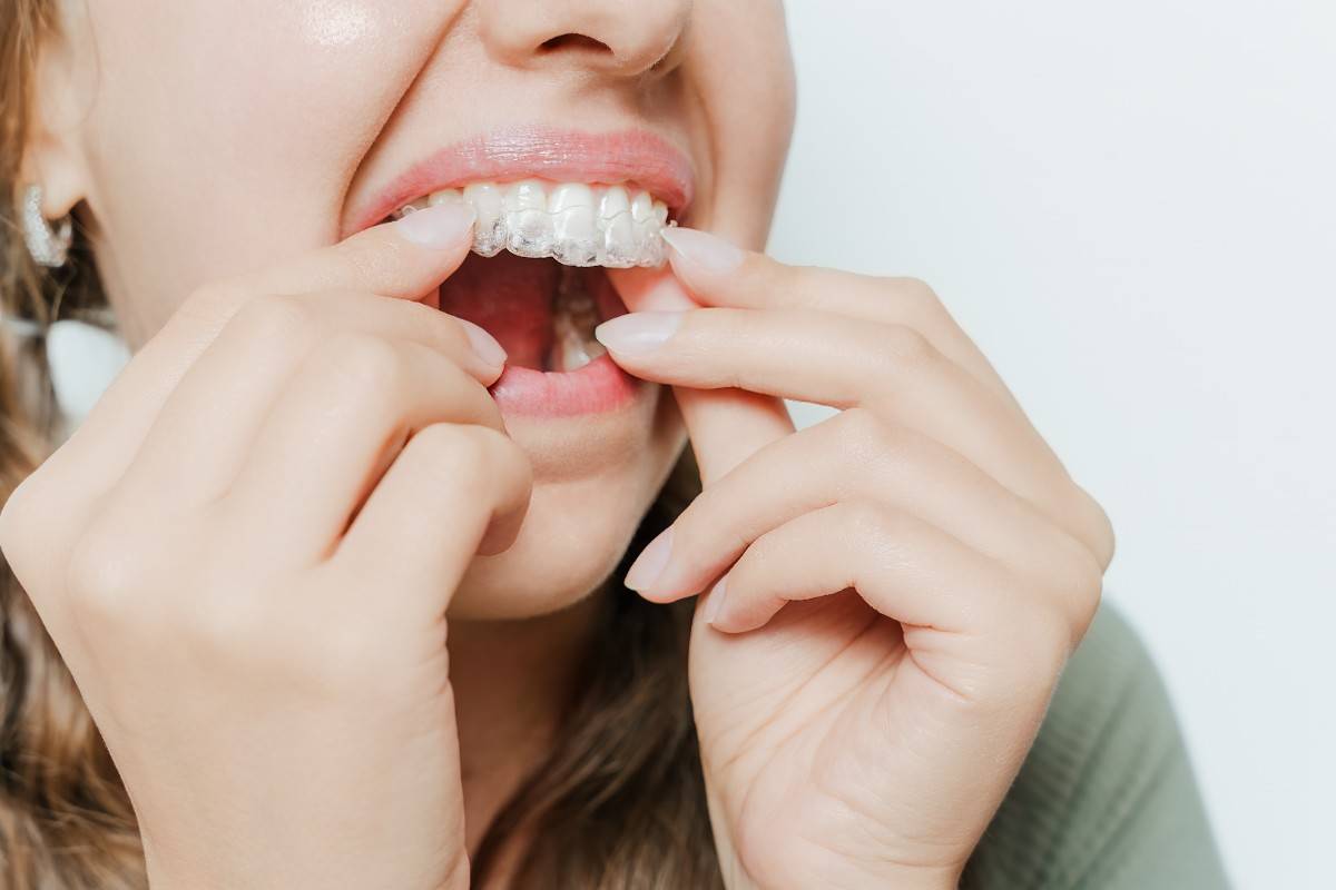 Invisalign® Comfort Tips for a Smooth Experience