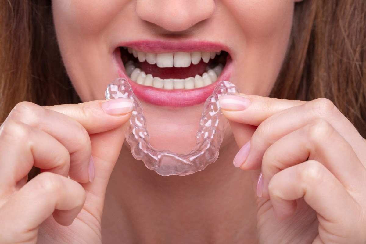 Can Invisalign Really Fix Crooked Front Teeth? A Look at Realistic Results
