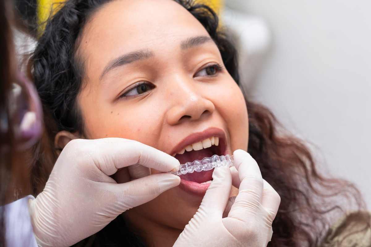 Single-Arch vs. Full Invisalign Treatment: Which One Is Right for You?